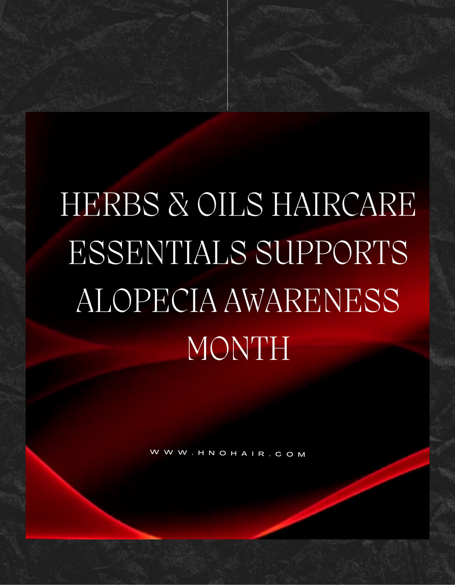 September is Alopecia Awareness Month - Focus on Traction Alopecia